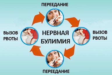 Лечение булимии в Шебекино